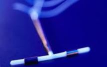Le stérilet bien plus efficace que la pilule pour éviter de tomber enceinte