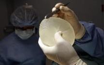 Près de 8.000 femmes se sont fait retirer leurs prothèses PIP