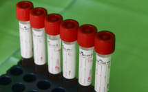 Martinique: la justice rejette une demande de dépistage systématique