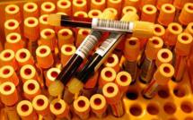 Sida: et si on vous dépistait au lieu d'attendre bêtement ?