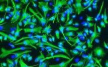 L'existence des cellules souches cancéreuses se confirme