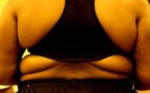 Cancer du sein : la surcharge pondérale augmente le risque d'un second cancer