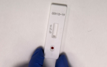 Coronavirus: moment de vérité pour les capacités de dépistage