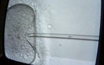 Des scientifiques créent des ovocytes viables à partir de cellules souches