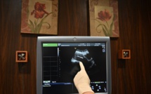 Don d'ovocytes dans un couple de femmes: le gouvernement est "contre", dit Véran