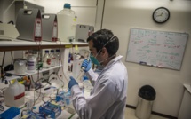 Covid-19: des chercheurs disent avoir découvert un premier cas de réinfection