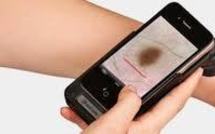 Japon: quand le smartphone se fait presque dermatologue