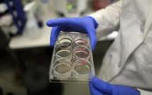 Le Sénat autorise la recherche sur l'embryon et les cellules souches