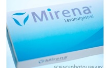 Bayer poursuivi aux Etats-Unis pour son stérilet Mirena