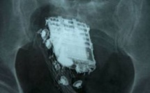 Un détenu trahi par la sonnerie du portable dissimulé dans... son corps