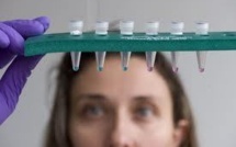 Cancer du foie: un virus modifié permet d'augmenter la survie