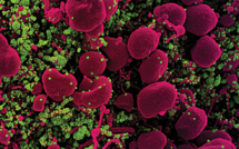 Covid-19 : que sait-on des variants britannique et sud-africain ?