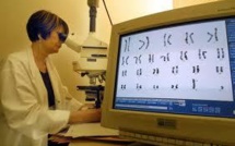 Le dépistage prénatal de la trisomie 21 au coeur d'une polémique