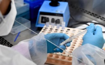 Séroprévalence : 117 prélèvements sanguins déjà effectués