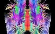 Japon: des chercheurs parviennent à décoder le contenu partiel de rêves