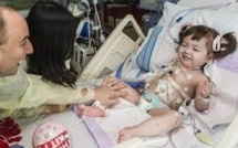 Greffe d'une trachée sur une enfant de deux ans, une première mondiale