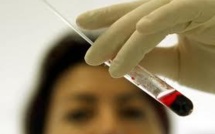 Le Parlement adopte définitivement la réforme de la biologie médicale