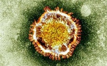 Nouveau coronavirus : état toujours stationnaire et sérieux pour les deux malades français