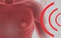 Prochaine cible pour les cyber-pirates: le corps humain