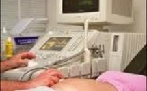 Déclencher les contractions pourrait accroître le risque d'autisme du bébé