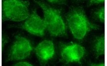 Une protéine joue un rôle-clé dans le déclin de la mémoire avec l'âge