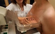 Cancer: un projet pour rendre les mammographies "plus supportables"