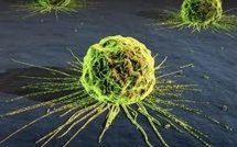 Le coût du cancer en Europe évalué à 126 mds EUR par an