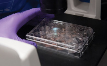 Cancer du col de l'utérus: un vaccin semble nettement limiter les risques