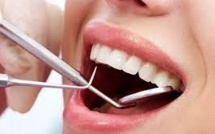 Une étude souligne les "dérives" tarifaires des soins dentaires