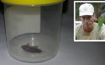 Il a très mal à l'oreille: le médecin extrait un cafard du conduit auditif