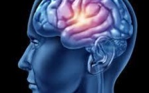 L'Académie de médecine lance un appel au don de cerveau post mortem