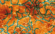 Un homme d'une soixantaine d'années décède de la leptospirose