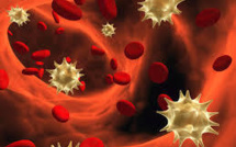 La listeriose continue de progresser et tuer dans l'UE