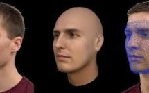 Reconstruction faciale: des "résultats incomparables" grâce à l'imprimante 3D