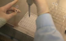 Variole du singe: une trentaine de cas suspects ou confirmés en Espagne et au Portugal