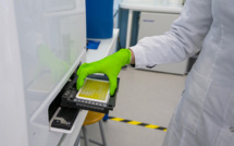 Premier cas de variole du singe en Italie