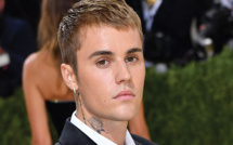 Le syndrome de Ramsay Hunt, dont souffre Justin Bieber: un trouble neurologique rare
