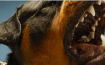 Un enfant de 18 mois mordu gravement à la tête par un chien