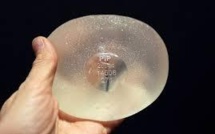 Implants PIP: pas de retrait préventif requis, selon les experts de la Commission Européenne