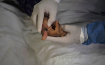 Cuba: un touriste italien meurt de la variole du singe, premier cas dans le pays