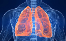 Journée de Lutte Contre la Broncho Pneumopathie Chronique Obstructive ce vendredi à Raiatea