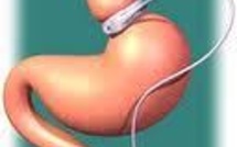 Chez les obèses, la chirurgie bariatrique plus efficace à long terme contre le diabète