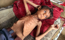 Une personne meurt de faim dans le monde toutes les quatre secondes (ONG)