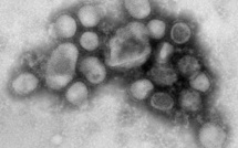 Des chercheurs créent des virus de la grippe H1N1 échappant au système immunitaire