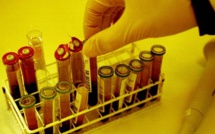 Sida : le bébé américain "guéri" grâce aux antirétroviraux testé séropositif