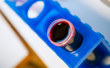 Paludisme: une espèce invasive de moustique gagne du terrain en Afrique