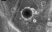 Des scientifiques argentins découvrent un champignon anti-chikungunya