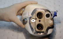 Un deuxième coeur artificiel Carmat implanté en France