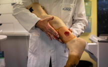 Cicatriser les plaies sévères: les pansements font leur révolution