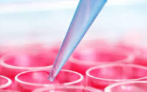 Japon: 1ère implantation mondiale sur l'homme de cellules issues de spécimens iPS